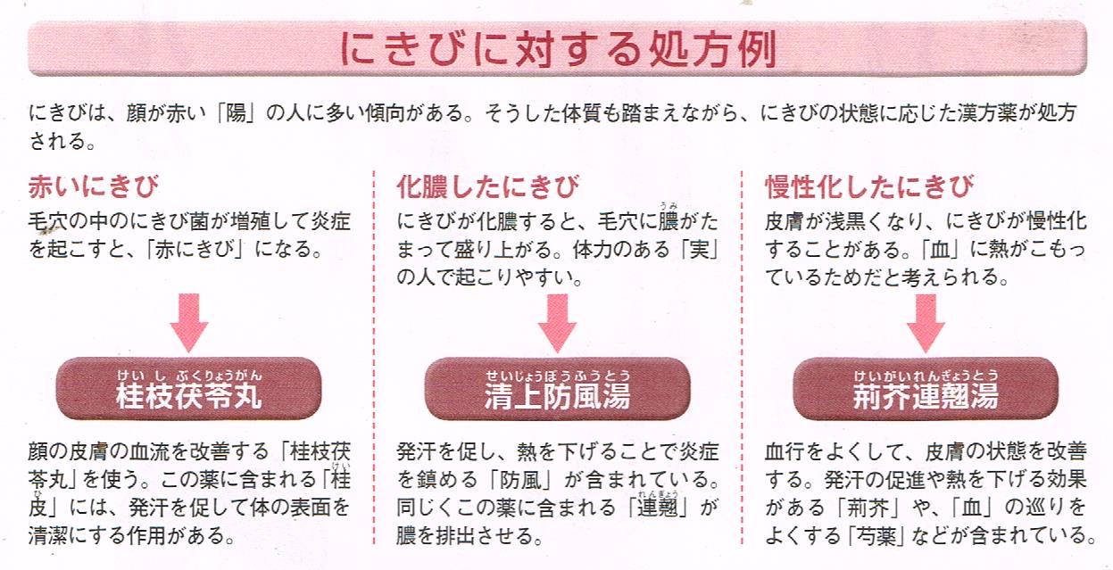 過敏性腸症候群に対する処方例