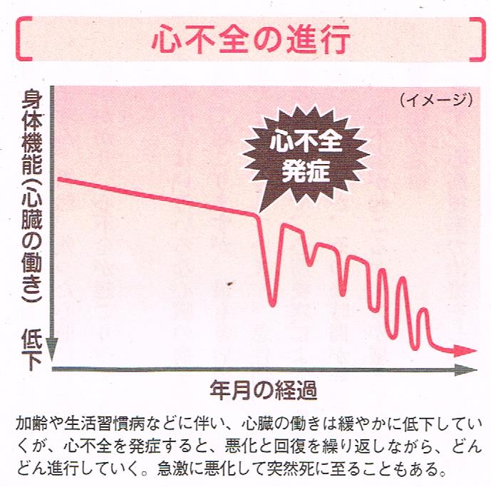 心不全の進行