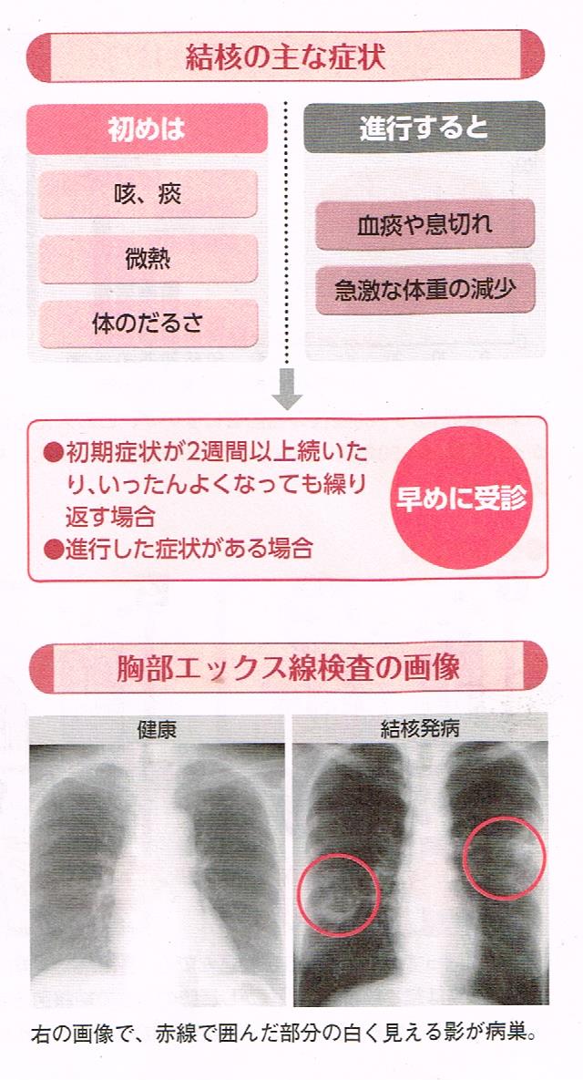 感染から発病へ