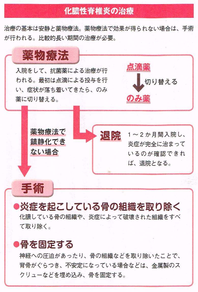 化膿性脊椎炎の治療