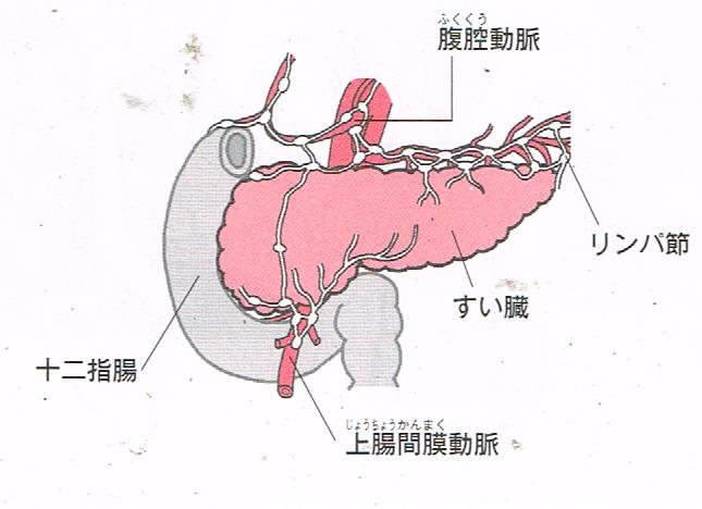 膵臓癌の周囲にあるリンパ節と主要な動脈