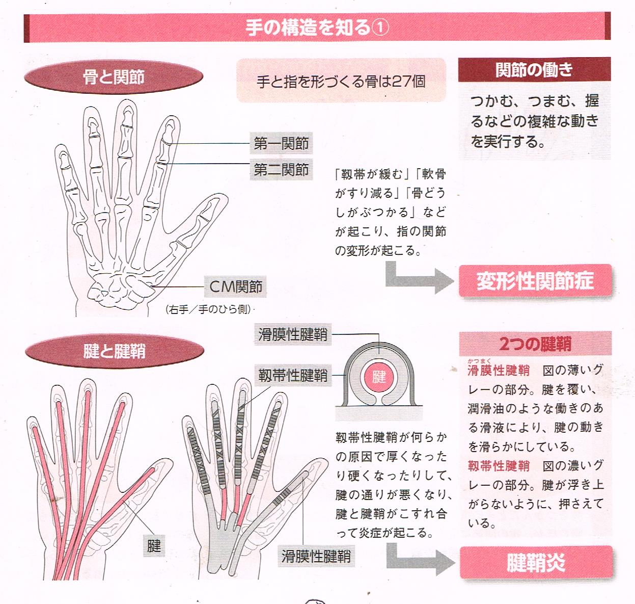 手の構造と起こりやすい病気①