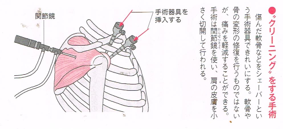 クリーニング